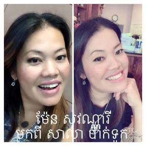 Meet your Posher, ម៉ែន